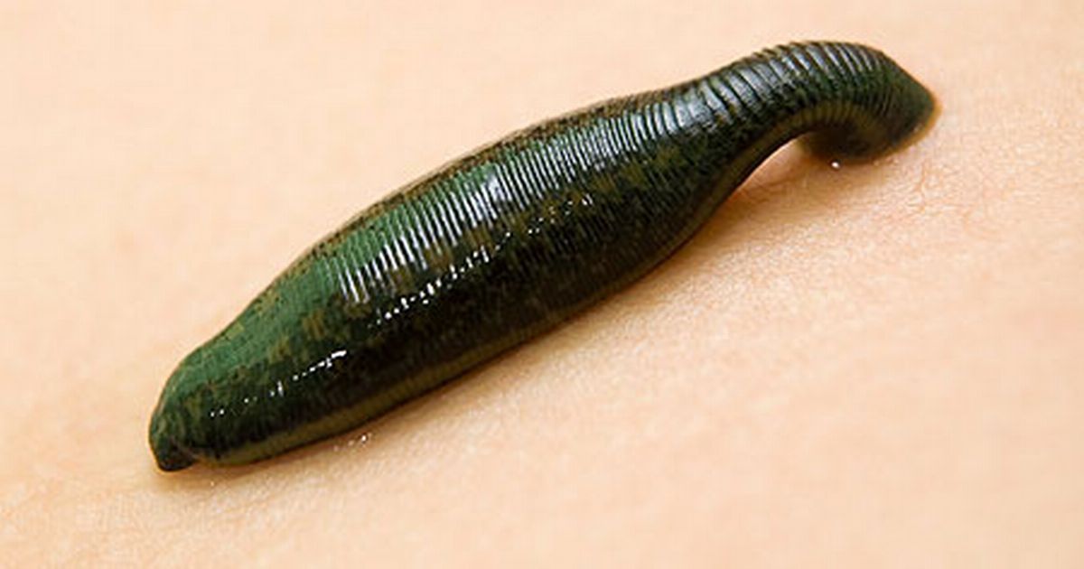 19 Hirudotherapeutic Leeches, our special mixed package